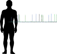 Imagen de un perfil de ADN