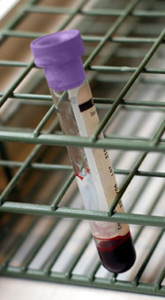 Image of blood in a test tube